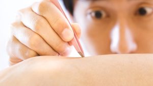 毛抜きをする男性